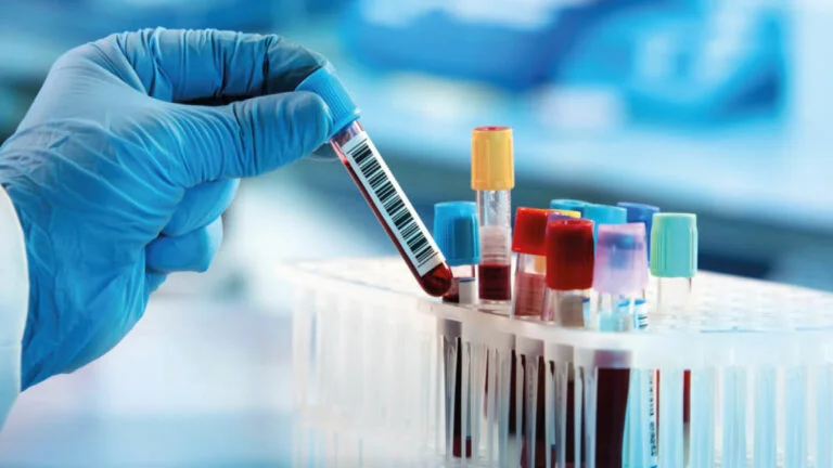 Lamina Ipanema – Conheça o laboratório de medicina diagnóstica no Rio